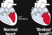 Kırık kalp sendromu