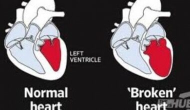 Kırık kalp sendromu